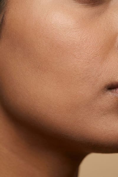 Illustration of dry skin — flaking and dehydrated texture